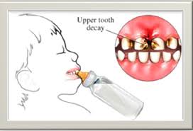 decayteethinfant